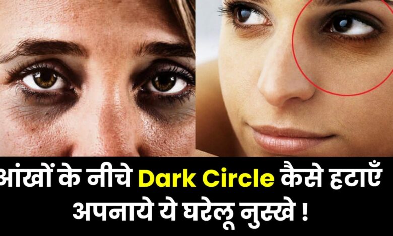 आँखों के नीचे Dark Circle कैसे हटायें